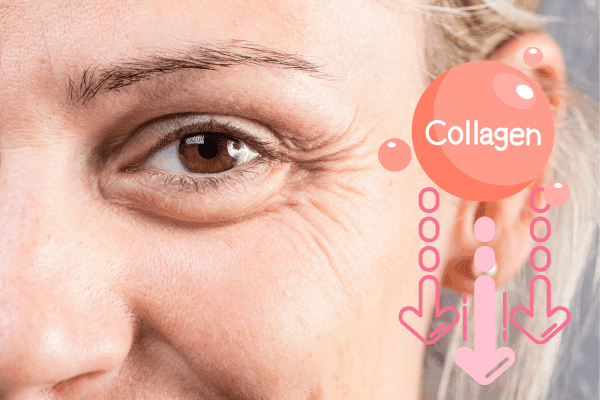 kollagenproduktion-sinkt